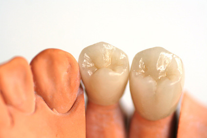 Os Tipos de prótese dentária Odontocap Clínicas Odontológicas